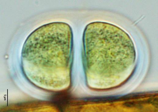 2厚膜色球藻Chroococcus turicensis（色球藻科Chroococcaceae）