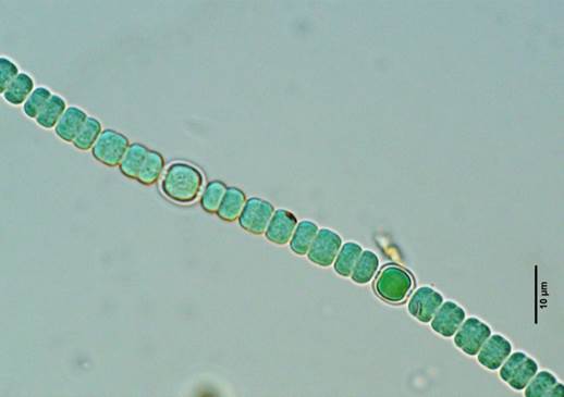 5稻田鱼腥藻Anabaena oryzae（念珠藻科Nostocaceae）