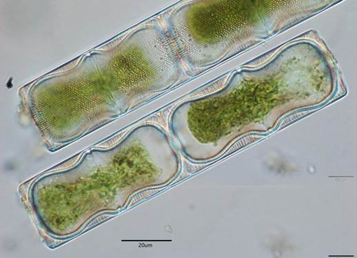 7波形直链藻Melosira undulate（圆筛藻科Coscinodiscaceae）