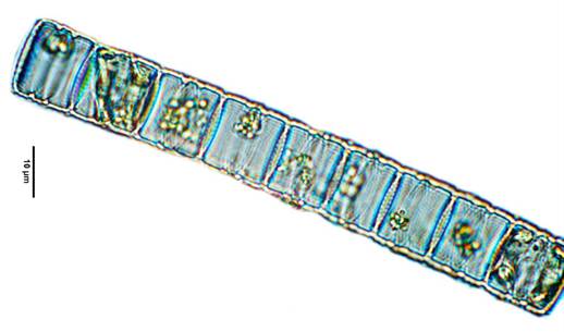 8颗粒直链藻Melosira granulata（圆筛藻科Coscinodiscaceae）