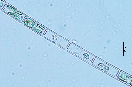 9变异直链藻Melosira varians（圆筛藻科Coscinodiscaceae）