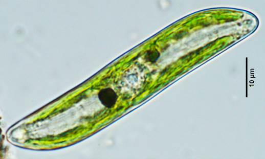 10优美布纹藻Gyrosigma eximium（舟形藻科Naviculaceae）