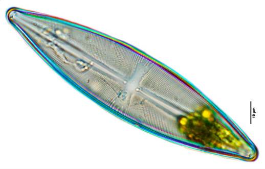 14双头辐节藻西伯利亚变种Stauroneis anceps var. siberica（舟形藻科Naviculaceae）