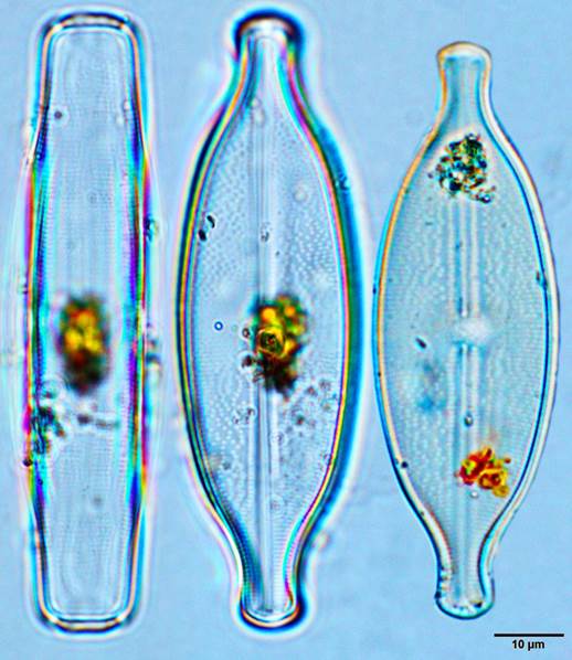 15具球异菱形藻Anomoeoneis sphaerophora（舟形藻科Naviculaceae）