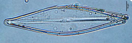 16急尖格形藻Craticula cuspidata（舟形藻科Naviculaceae）