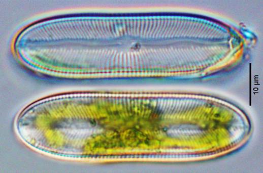 18静水舟形藻Navicula stagna（舟形藻科Naviculaceae）