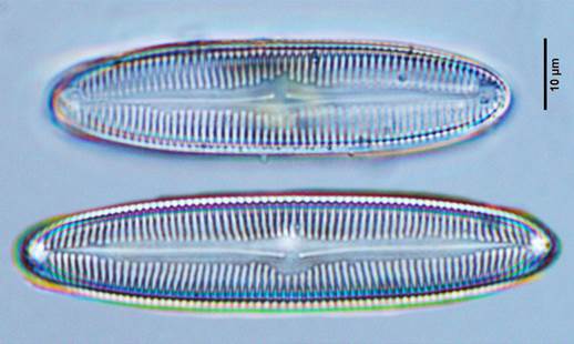 20楔形羽纹藻Pinnularia cuneata（舟形藻科Naviculaceae）