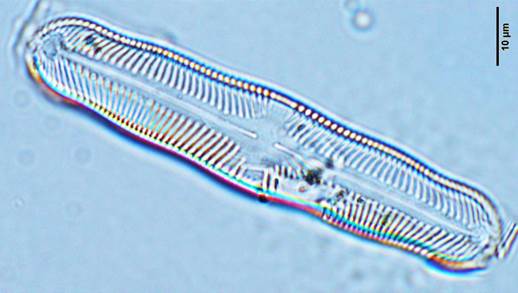 21小十字羽纹藻长变种Pinnularia stauroptera var. longa（舟形藻科Naviculaceae）