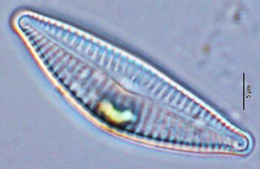 24切断桥弯藻Cymbella excisa（桥弯藻科Cwnbellaceae）