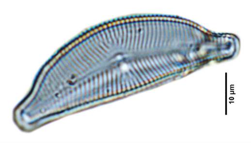 25膨胀桥弯藻Cymbella tumida（桥弯藻科Cwnbellaceae）
