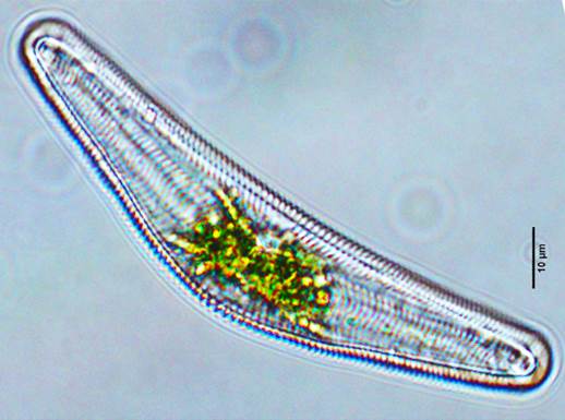 26内弯桥弯藻Cymbella incurvata（桥弯藻科Cwnbellaceae）