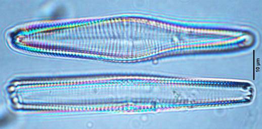 27纤细异极藻Gomphonema gracile（异极藻科Gomphonemaceae）