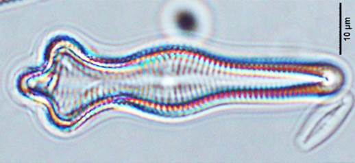 28尖异极藻Gomphonema acuminatum（异极藻科Gomphonemaceae）