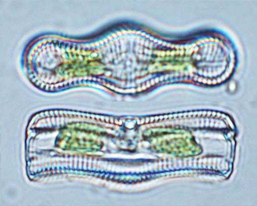 29膨大曲壳藻A. inflata（曲壳藻科Achnanthaceae）