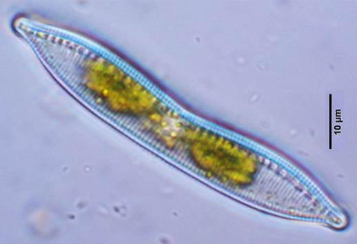 30密集菱板藻Hantzschia compacta（菱形藻科Nitzschiaceae）