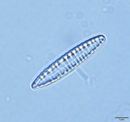 31两栖菱形藻Nitzschia amphibia（菱形藻科Nitzschiaceae）