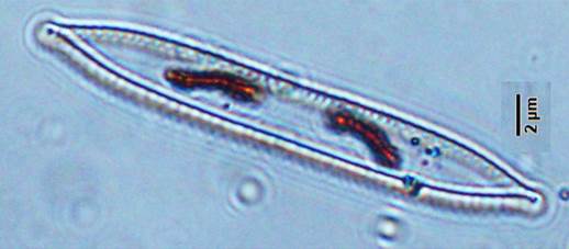 32谷皮菱形藻Nitzschia  palea（菱形藻科Nitzschiaceae）