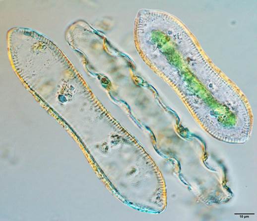 33草鞋形波缘藻Cymatopleura solea（双菱藻科Surirellaceae）