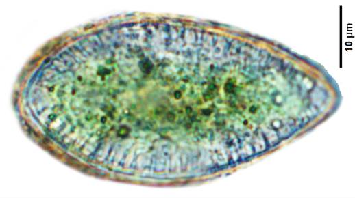 34卵形双菱藻Surirella ovata（双菱藻科Surirellaceae）