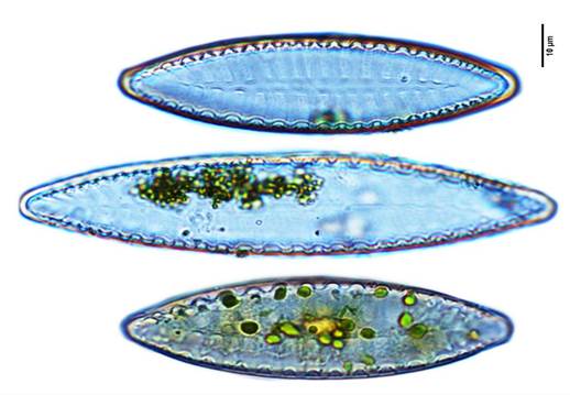 36线性双菱藻Surirella linearis（双菱藻科Surirellaceae）