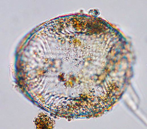 37冬生马鞍藻Campylodiscus hibernicus（双菱藻科Surirellaceae）