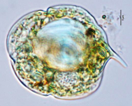 40尖爪扁裸藻Phacus unguis（裸藻科Euglenaceae）