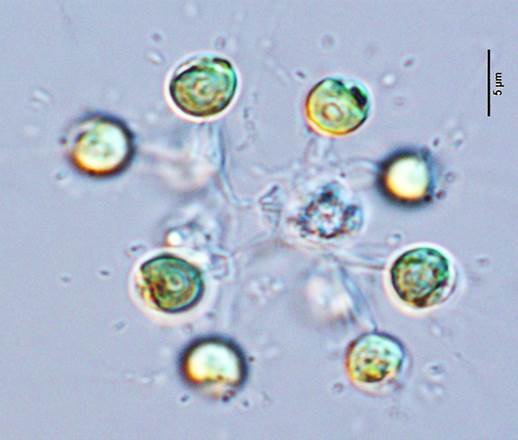 44美丽网球藻Dictyosphaerium pulchellum（网球藻科Dictyosphaeraceae）