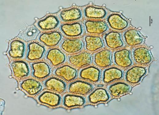 45短棘盘星藻短角变种Pediastrum  boryanum var. brevicorne（盘星藻科Pediastraceae）