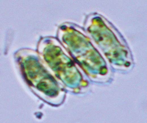 47顶棘栅藻Scenedesmus aculeolatus（栅藻科Scenedesmaceae）