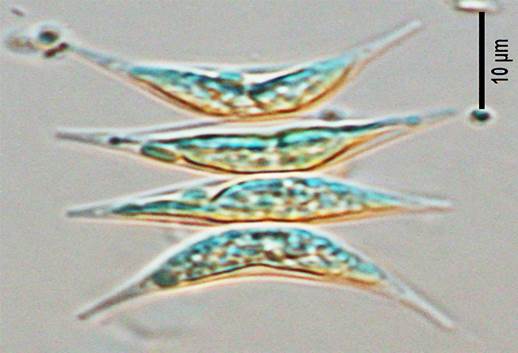 48二形栅藻Scenedesmus dimorphus（栅藻科Scenedesmaceae）