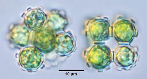 49钝空星藻Coelastrum morus（栅藻科Scenedesmaceae）