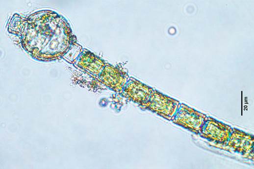 52孟加拉鞘藻Oedogonium bengalense（鞘藻科Oedogoniaceae）