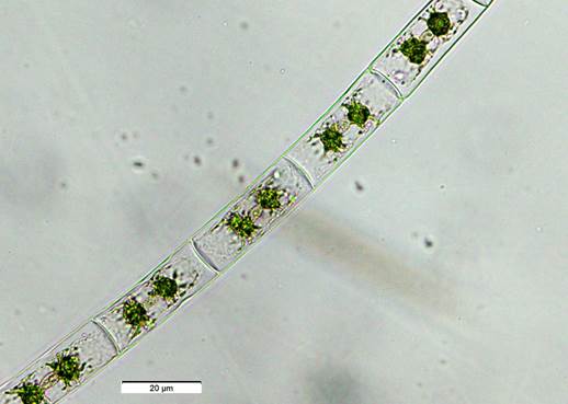 54双星藻Zygnema sp.（双星藻科Zygnemataceae）