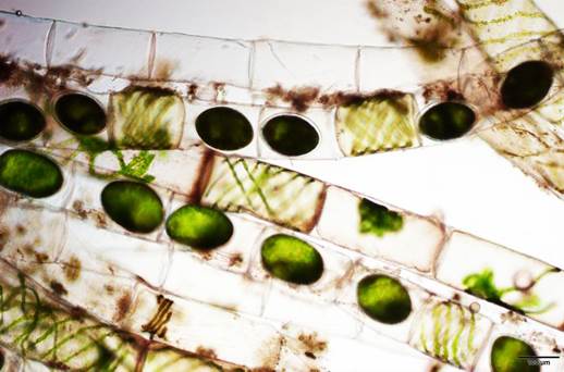 55晶莹水绵Spirogyra hyalina（双星藻科Zygnemataceae）