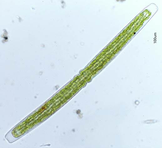 60埃伦宽带鼓藻Pleurotaenium ehrenbergii(鼓藻科Desmidiaceae)