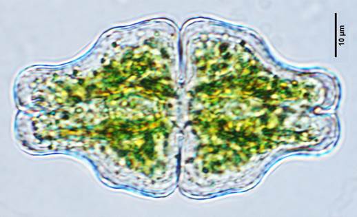 61凹顶鼓藻Euastrum ansatum(鼓藻科Desmidiaceae)
