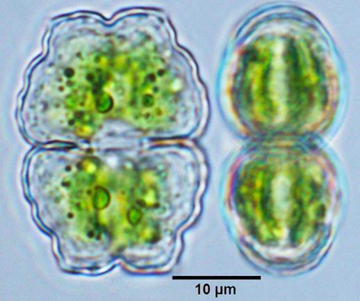 62小齿凹顶鼓藻狭变种Euastrum denticulatum var. angusticeps(鼓藻科Desmidiaceae)