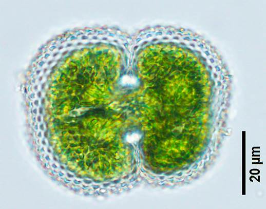 64珍珠鼓藻Cosmarium margaritatum(鼓藻科Desmidiaceae)