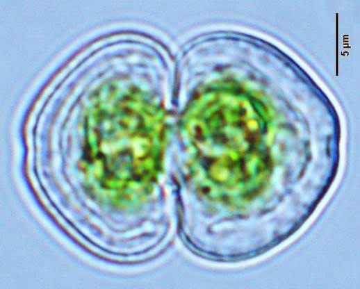 65帽状鼓藻Cosmarium galeritum(鼓藻科Desmidiaceae)