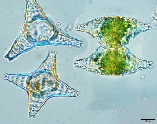 66珍珠角星鼓藻Staurastrum margaritaceum(鼓藻科Desmidiaceae)